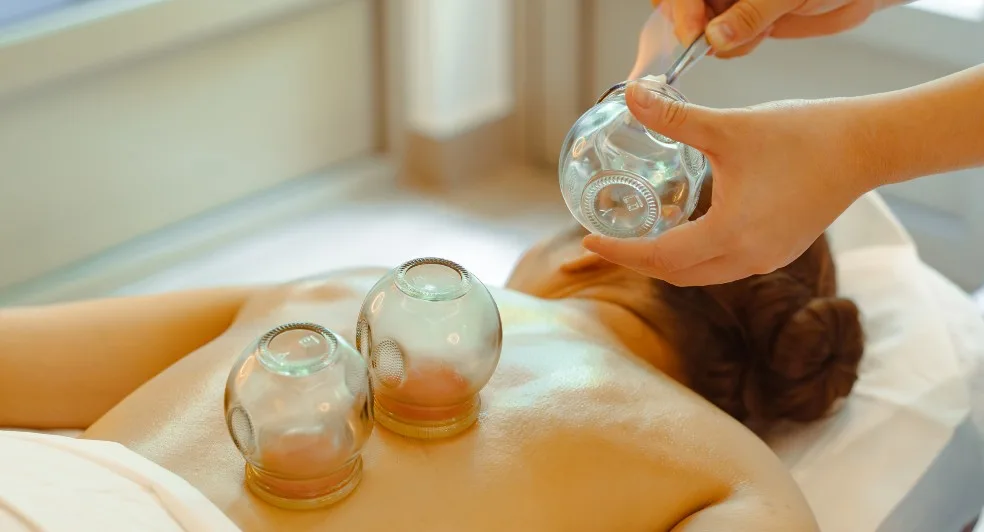 Cupping Therapy
